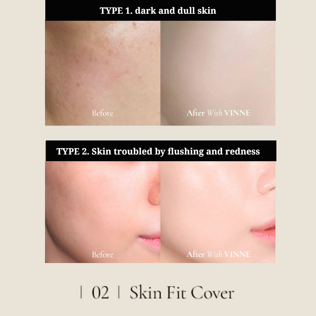 Vinne Skin Fit Cover